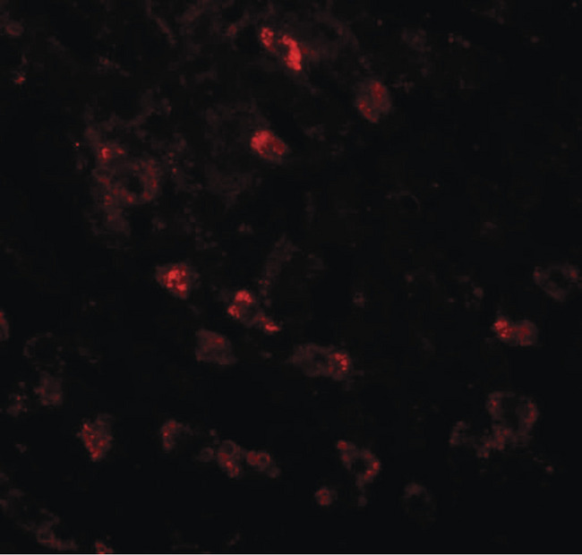 APC6 / CDC16 Antibody - Immunofluorescence of APC6 in human liver tissue with APC6 antibody at 20 ug/ml.