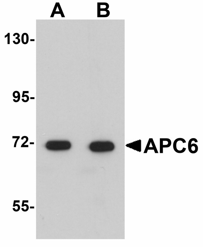 APC6 / CDC16 Antibody - Western blot of APC6 in human liver tissue lysate with APC6 antibody at (A) 1 and (B) 2 ug/ml.