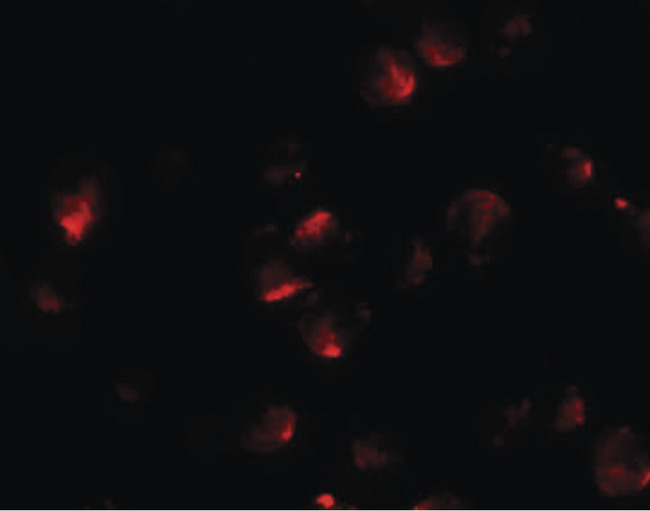 APCL / APC2 Antibody - Immunofluorescence of APC2 in HeLa cells with APC2 antibody at 20 ug/ml.