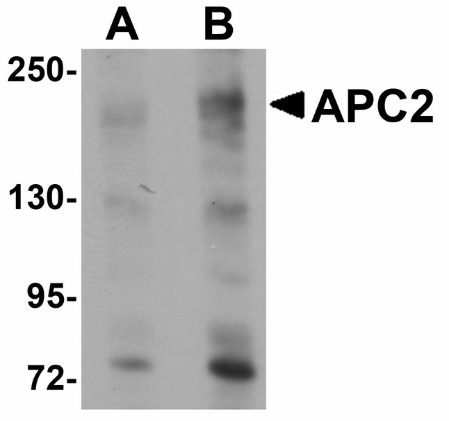 APCL / APC2 Antibody - Western blot of APC2 in HeLa cell lysate with APC2 antibody at (A) 1 and (B) 2 ug/ml.