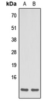 Apelin Antibody - Western blot analysis of Apelin expression in HEK293T (A); HeLa (B) whole cell lysates.
