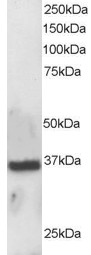 APEX1 / APE1 Antibody - Staining (0.5 ug/ml) of A431 lysate (RIPA buffer, 30 ug total protein per lane). Primary incubated for 1 hour. Detected using chemiluminescence.