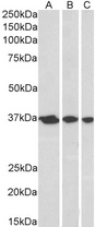 APEX1 / APE1 Antibody - Goat Anti-APE1 / APEX1 Antibody (0.3µg/ml) staining of A431 (A), HeLa (B) and MCF7 (C) nuclear lysates (35µg protein in RIPA buffer). Primary incubation was 1 hour. Detected by chemiluminescencence.