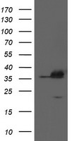 APEX1 / APE1 Antibody - HEK293T cells were transfected with the pCMV6-ENTRY control (Left lane) or pCMV6-ENTRY APEX1 (Right lane) cDNA for 48 hrs and lysed. Equivalent amounts of cell lysates (5 ug per lane) were separated by SDS-PAGE and immunoblotted with anti-APEX1.