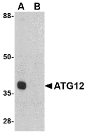 APG12 / ATG12 Antibody - Western blot of ATG12 in mouse heart tissue lysate with ATG12 antibody at 1 ug/ml in (A) the absence and (B) the presence of blocking peptide.