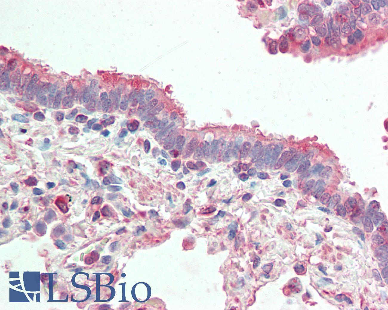 APG4B / ATG4B Antibody - Anti-APG4B / ATG4B antibody IHC staining of human lung, respiratory epithelium. Immunohistochemistry of formalin-fixed, paraffin-embedded tissue after heat-induced antigen retrieval. Antibody dilution 1:50.