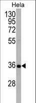 APG5 / ATG5 Antibody - APG5L Antibody (D3) western blot of HeLa cell line lysates (35 ug/lane). The APG5L antibody detected the APG5L protein (arrow).