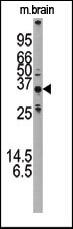 APG5 / ATG5 Antibody - The anti-APG5L antibody is used in Western blot to detect APG5L in mouse brain tissue lysate.