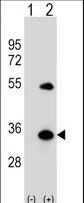 APG5 / ATG5 Antibody - Western blot of APG5L (arrow) using rabbit polyclonal APG5L Antibody (D3). 293 cell lysates (2 ug/lane) either nontransfected (Lane 1) or transiently transfected (Lane 2) with the APG5L gene.