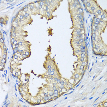 APG5 / ATG5 Antibody - Immunohistochemistry of paraffin-embedded human prostate, with a concentration of 1:100.