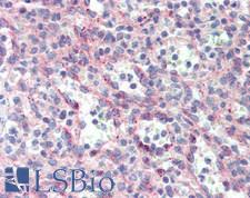 APG5 / ATG5 Antibody - Human Spleen: Formalin-Fixed, Paraffin-Embedded (FFPE), at a dilution of 1:200.