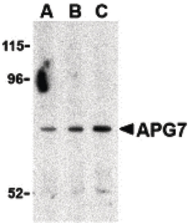 Apg7 / ATG7 Antibody - Western blot of APG7 in Caco-2 cell lysate with APG7 antibody at (A) 0.5, (B) 1 and (C) 2 ug/ml.