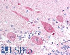 APH1A / APH-1 Antibody - Anti-APH1A antibody IHC of human brain, cerebellum. Immunohistochemistry of formalin-fixed, paraffin-embedded tissue after heat-induced antigen retrieval. Antibody concentration 5 ug/ml.