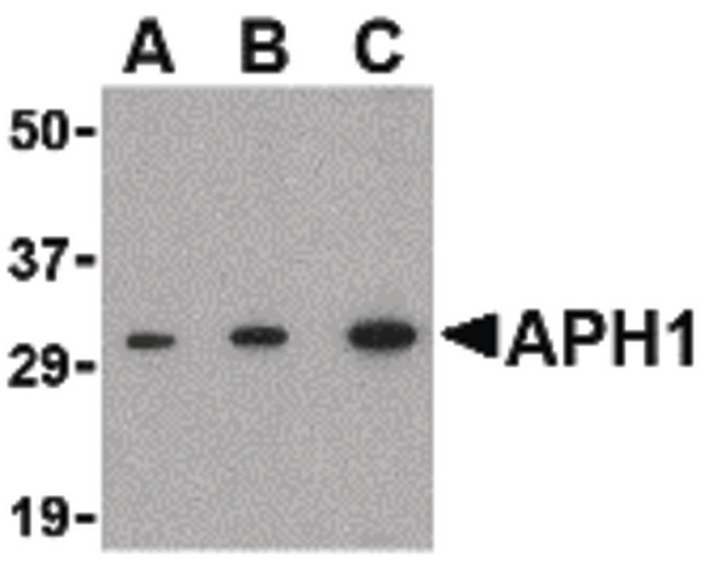 APH1A / APH-1 Antibody - Western blot of APH1 in RAW264.7 cell lysate with APH1 antibody at (A) 0.5, (B) 1 and (C) 2 ug/ml.