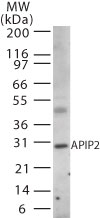 APIP Antibody - Western blot of APIP2 in human muscle using antibody at 2 ug/ml.