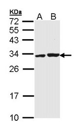 APIP Antibody - Sample (30 ug of whole cell lysate). A: Molt-4. B: Raji. 12% SDS PAGE. APIP antibody diluted at 1:1000. 