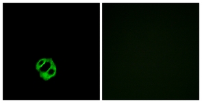 APLNR/ Apelin Receptor / APJ Antibody - Immunofluorescence analysis of MCF7 cells, using AGTRL1 Antibody. The picture on the right is blocked with the synthesized peptide. 