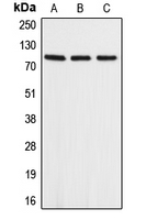 APLP2 Antibody - Western blot analysis of APLP2 expression in A549 (A); mouse heart (B); rat heart (C) whole cell lysates.