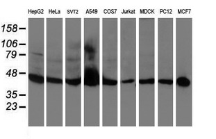 APMAP / C20orf3 Antibody - Western blot of extracts (35 ug) from 9 different cell lines by using anti-C20orf3 monoclonal antibody.