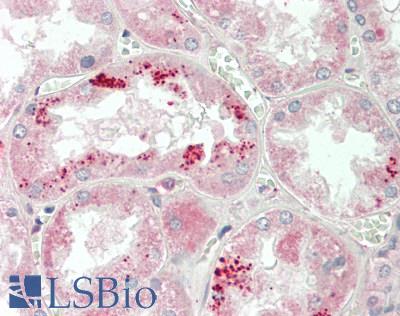 APOA1 / Apolipoprotein A 1 Antibody - Human Kidney: Formalin-Fixed, Paraffin-Embedded (FFPE)