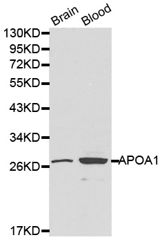 APOA1 / Apolipoprotein A 1 Antibody - Western blot analysis of brain cell and blood cell lysate.