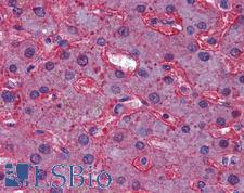 APOA1 / Apolipoprotein A 1 Antibody - Anti-Apolipoprotein A I antibody IHC of human liver. Immunohistochemistry of formalin-fixed, paraffin-embedded tissue after heat-induced antigen retrieval. Antibody dilution 1:100.