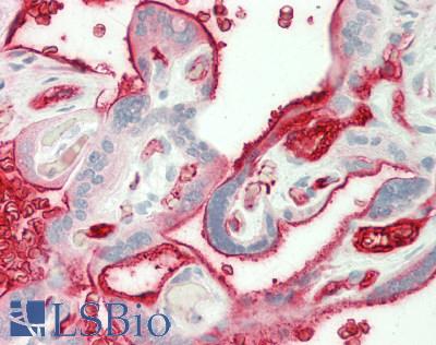 APOB / Apolipoprotein B Antibody - Human Placenta: Formalin-Fixed, Paraffin-Embedded (FFPE)