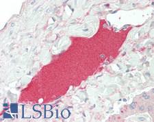 APOB / Apolipoprotein B Antibody - Human Liver: Formalin-Fixed, Paraffin-Embedded (FFPE)