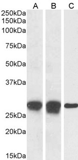 APOBEC3A Antibody - Phorbolin 1 / APOBEC3A antibody (1µg/ml) staining of Human Spleen (A), Tonsil (B) and (0.1ug/ml) PBM (C) lysate (35µg protein in RIPA buffer). Detected by chemiluminescence.