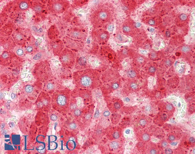 APOC3 / Apolipoprotein C III Antibody - Anti-APOC3 / Apolipoprotein C III antibody IHC staining of human liver. Immunohistochemistry of formalin-fixed, paraffin-embedded tissue after heat-induced antigen retrieval. Antibody concentration 2.5 ug/ml.