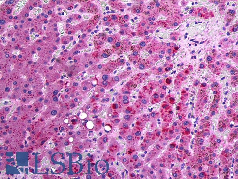 APOC3 / Apolipoprotein C III Antibody - Anti-APOC3 / Apolipoprotein CIII antibody IHC of human liver. Immunohistochemistry of formalin-fixed, paraffin-embedded tissue after heat-induced antigen retrieval. Antibody concentration 5 ug/ml.