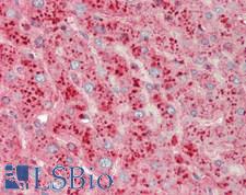 APOD / Apolipoprotein D Antibody - Human Liver: Formalin-Fixed, Paraffin-Embedded (FFPE)