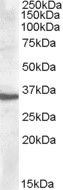 APOF / Apolipoprotein F Antibody - Antibody (0.5 ug/ml) staining of Human Liver lysate (35 ug protein in RIPA buffer). Primary incubation was 1 hour. Detected by chemiluminescence.