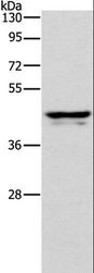 APOL1 / Apolipoprotein L Antibody - Western blot analysis of Human plasma tissue, using APOL1 Polyclonal Antibody at dilution of 1:400.