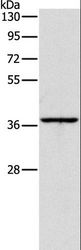 APOL2 / Apolipoprotein L 2 Antibody - Western blot analysis of Huvec cell, using APOL2 Polyclonal Antibody at dilution of 1:375.