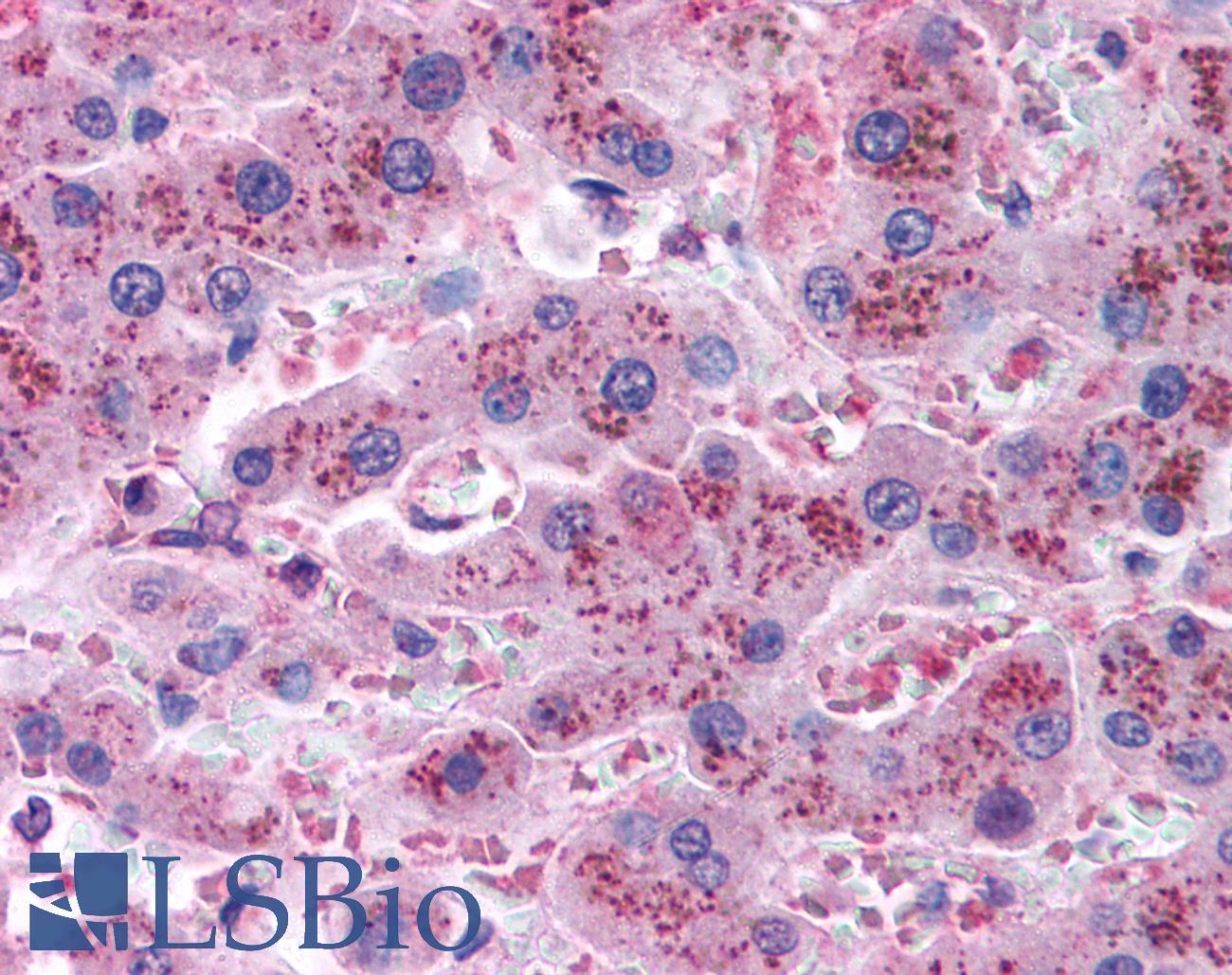 Apolipoprotein A-V Antibody - Anti-APOA5 antibody IHC of human liver. Immunohistochemistry of formalin-fixed, paraffin-embedded tissue after heat-induced antigen retrieval. Antibody concentration 20 ug/ml.