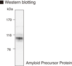 APP / Beta Amyloid Precursor Antibody