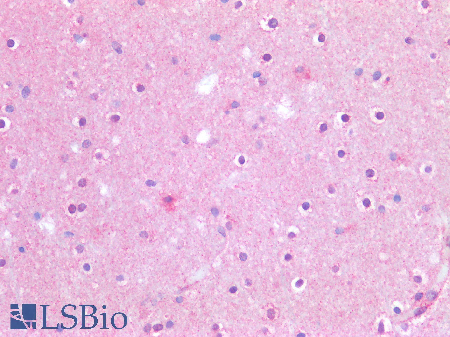 APP / Beta Amyloid Precursor Antibody - Human Brain, Cortex: Formalin-Fixed, Paraffin-Embedded (FFPE)