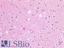 APP / Beta Amyloid Precursor Antibody - Human Brain, Cortex: Formalin-Fixed, Paraffin-Embedded (FFPE)