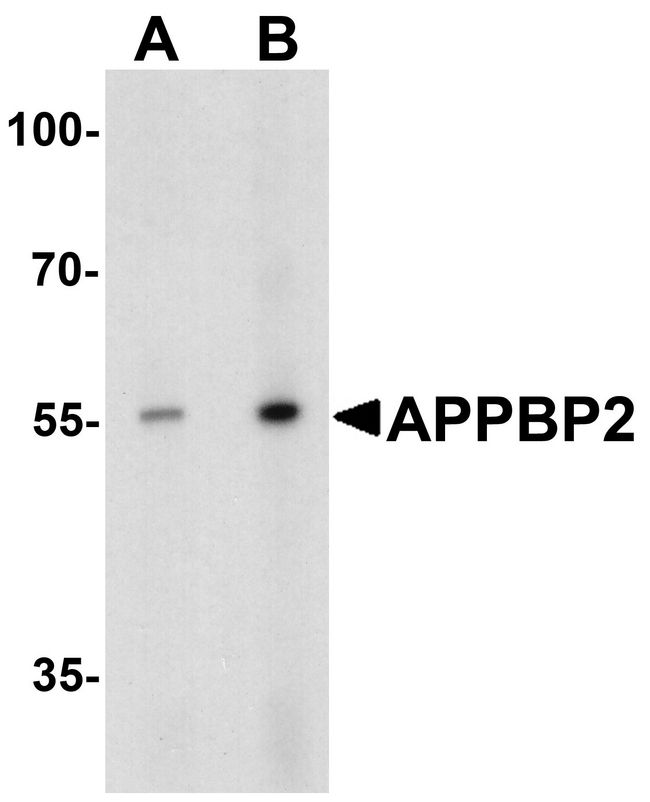 APPBP2 Antibody - Western blot analysis of APPBP2 in human brain tissue lysate with APPBP2 antibody at (A) 0.5 and (B) 1 ug/ml.