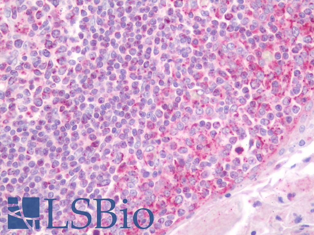 APPL1 / APPL Antibody - Anti-APPL1 / APPL antibody IHC staining of human tonsil. Immunohistochemistry of formalin-fixed, paraffin-embedded tissue after heat-induced antigen retrieval. Antibody dilution 1:50.