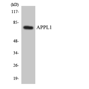 APPL1 / APPL Antibody - Western blot analysis of the lysates from K562 cells using APPL1 antibody.