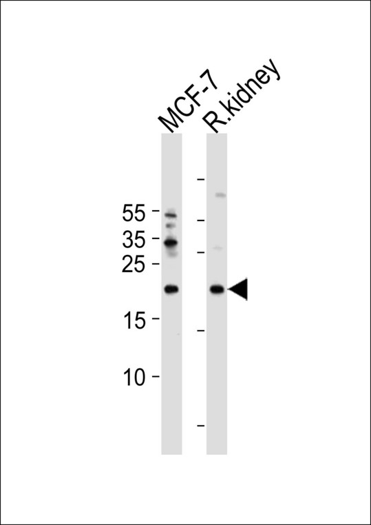 APRT Antibody - APRT Antibody western blot of MCF-7 cell line and rat kidney tissue lysates (35 ug/lane). The APRT antibody detected the APRT protein (arrow).