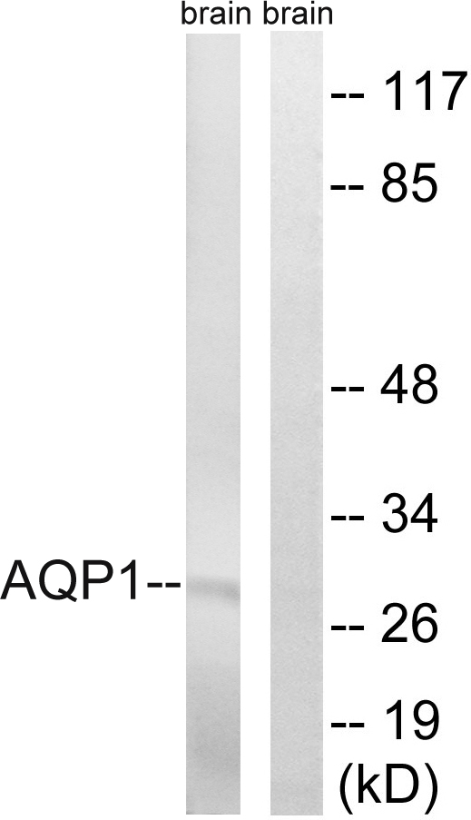 AQP1 / Aquaporin 1 Antibody - Western blot analysis of lysates from rat brain cells, using AQP1 Antibody. The lane on the right is blocked with the synthesized peptide.