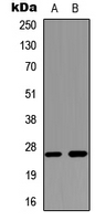 AQP2 / Aquaporin 2 Antibody - Western blot analysis of Aquaporin 2 expression in human kidney (A); mouse heart (B) whole cell lysates.