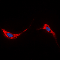 AQP2 / Aquaporin 2 Antibody - Immunofluorescent analysis of Aquaporin 2 staining in HeLa cells. Formalin-fixed cells were permeabilized with 0.1% Triton X-100 in TBS for 5-10 minutes and blocked with 3% BSA-PBS for 30 minutes at room temperature. Cells were probed with the primary antibody in 3% BSA-PBS and incubated overnight at 4 C in a humidified chamber. Cells were washed with PBST and incubated with a DyLight 594-conjugated secondary antibody (red) in PBS at room temperature in the dark. DAPI was used to stain the cell nuclei (blue).