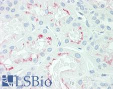 AQP3 / Aquaporin 3 Antibody - Anti-AQP3 / Aquaporin 3 antibody IHC staining of human kidney. Immunohistochemistry of formalin-fixed, paraffin-embedded tissue after heat-induced antigen retrieval. Antibody dilution 1:50.