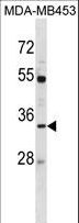 AQP3 / Aquaporin 3 Antibody - AQP3 Antibody western blot of MDA-MB453 cell line lysates (35 ug/lane). The AQP3 antibody detected the AQP3 protein (arrow).