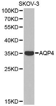 AQP4 / Aquaporin 4 Antibody - Western blot analysis of extracts of SKOV-3 cell line, using AQP4 antibody.
