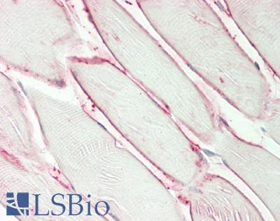 AQP4 / Aquaporin 4 Antibody - Human Skeletal Muscle: Formalin-Fixed, Paraffin-Embedded (FFPE)